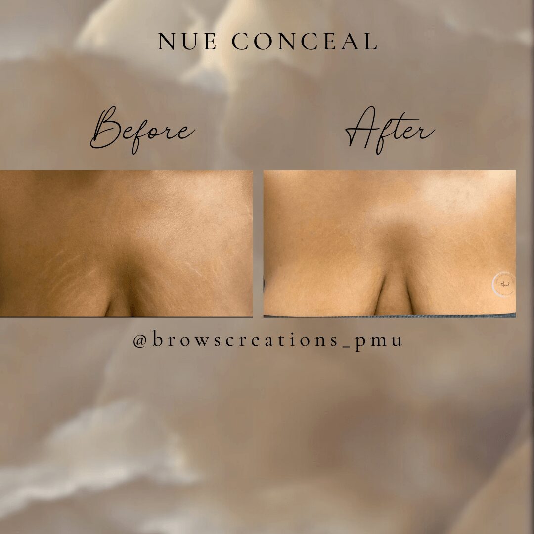 Close-up comparison of skin treatment results, showing 'Before' and 'After' panels. 'After' panel displays smoother skin. Text includes "Nue Conceal" and a tag "@browscreations_pmu.